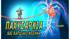 παχυσαρκία — GR news